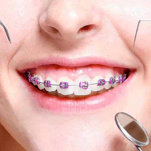 arabic-orthodontics-3